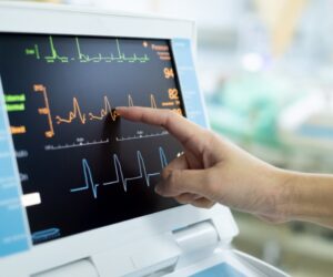EKG Services in Cypress